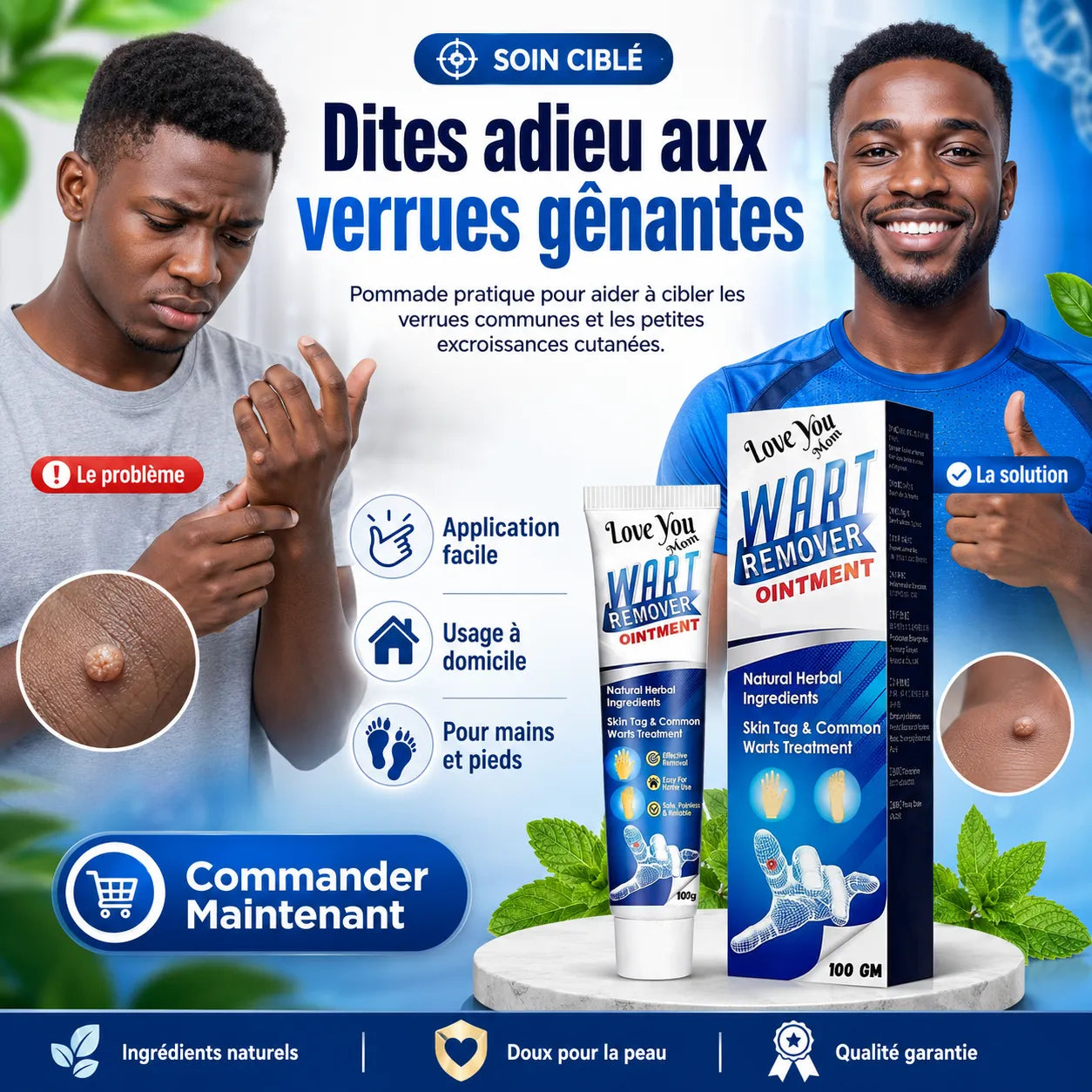 Dites Adieu Aux Verrues Gênantes GN